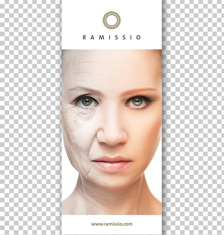 Face Cosmetics Skin Cream Wrinkle PNG, Clipart, Ageing, Antiaging Cream, Beauty, Cheek, Chin Free PNG Download