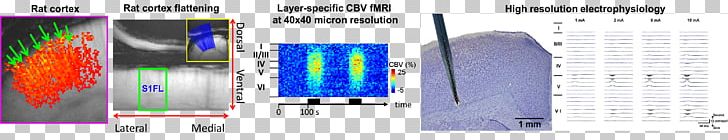 Functional Magnetic Resonance Imaging Laboratory Neuroimaging Electrophysiology Optogenetics PNG, Clipart, Biological Neural Network, Blue, Brain, Brand, Deep Brain Stimulation Free PNG Download