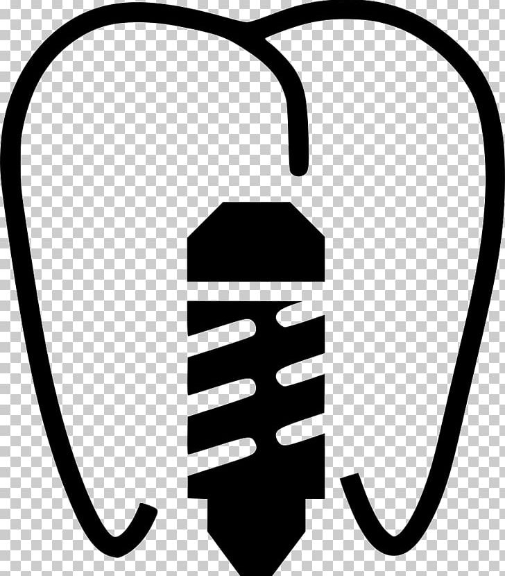 Cosmetic Dentistry Dental Implant Tooth PNG, Clipart, Black, Black And White, Clinic, Cosmetic Dentistry, Dental Implant Free PNG Download