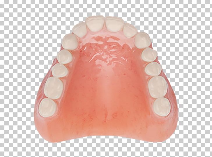 Tooth Dentures Dentistry Removable Partial Denture Aspen Dental PNG, Clipart, Aspen Dental, Clinic, Complexion, Dentistry, Dentures Free PNG Download