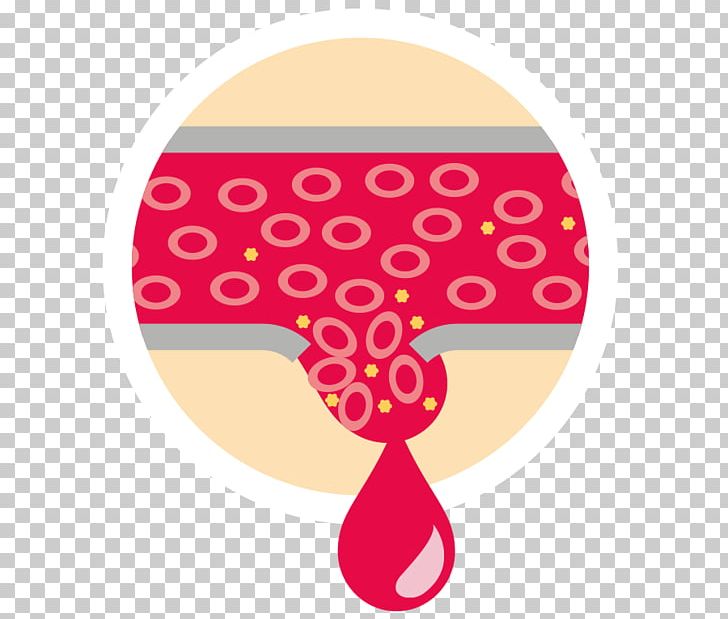 Bleeding Cancer Blood Vessel Lymphoma PNG, Clipart, Bcell Chronic Lymphocytic Leukemia, Bleeding, Blood, Blood Vessel, Breast Cancer Free PNG Download