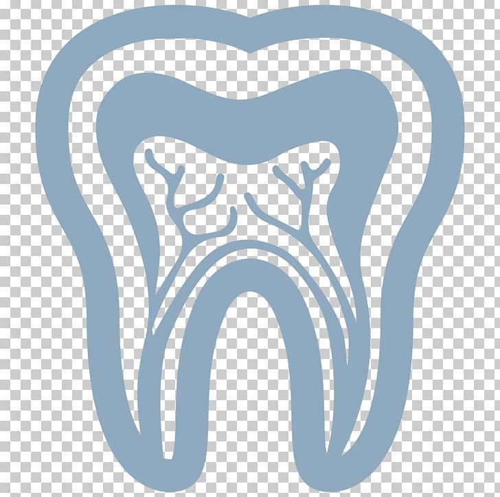 Tooth Dentistry Dental Implant Periodontal Disease PNG, Clipart, Area, Blue, Bone Grafting, Dental, Dental Restoration Free PNG Download
