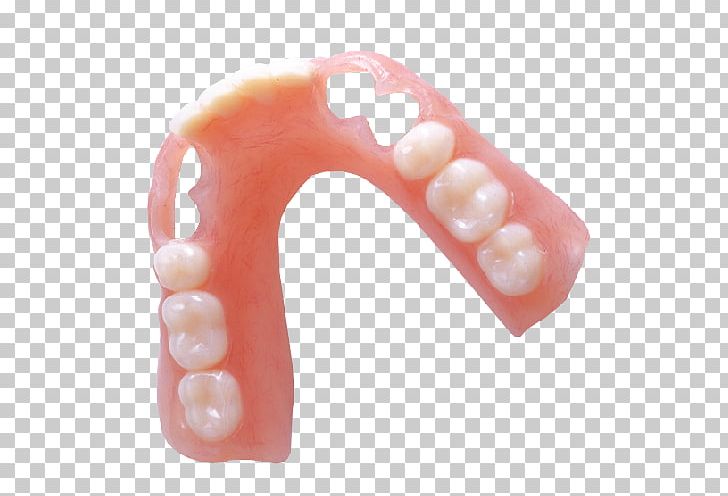 Dentures Removable Partial Denture Dental Laboratory Dentistry Vitallium PNG, Clipart, Acrylic Resin, Allure Dental Lab, Biocompatibility, Body Jewelry, Cosmetic Free PNG Download