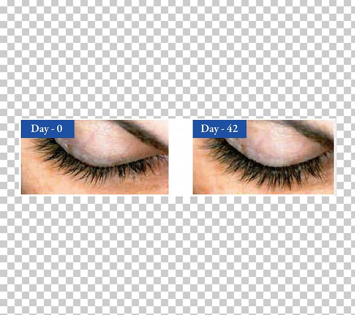 Eyelash Extensions あんぬクリニック Science Eye Shadow PNG, Clipart, Closeup, Cosmetics, Eye, Eyebrow, Eyelash Free PNG Download