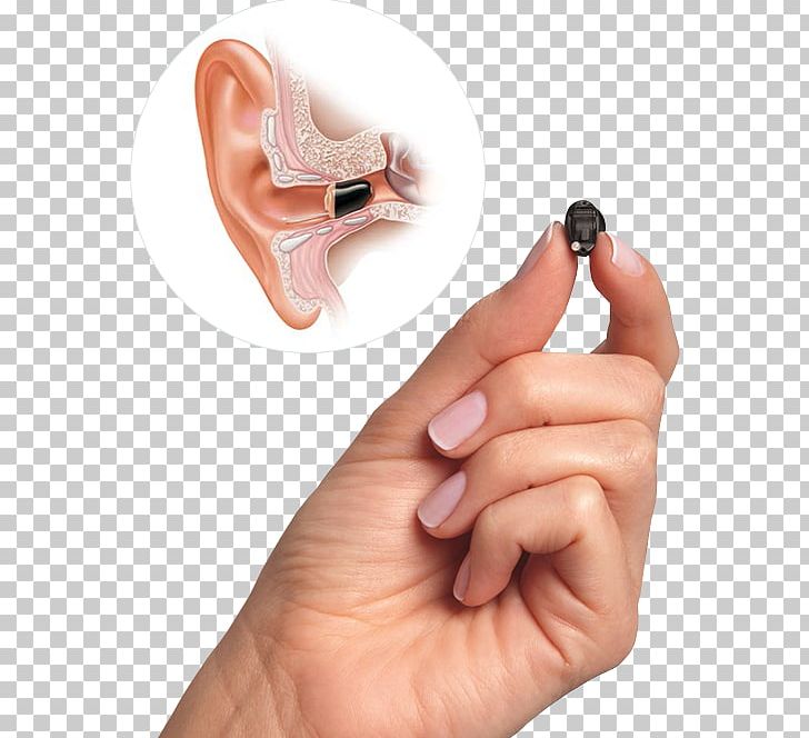 Primary Audiology Hearing Aid PNG, Clipart, Aids, Audiology, Ear, Earwax, Evaluation Free PNG Download