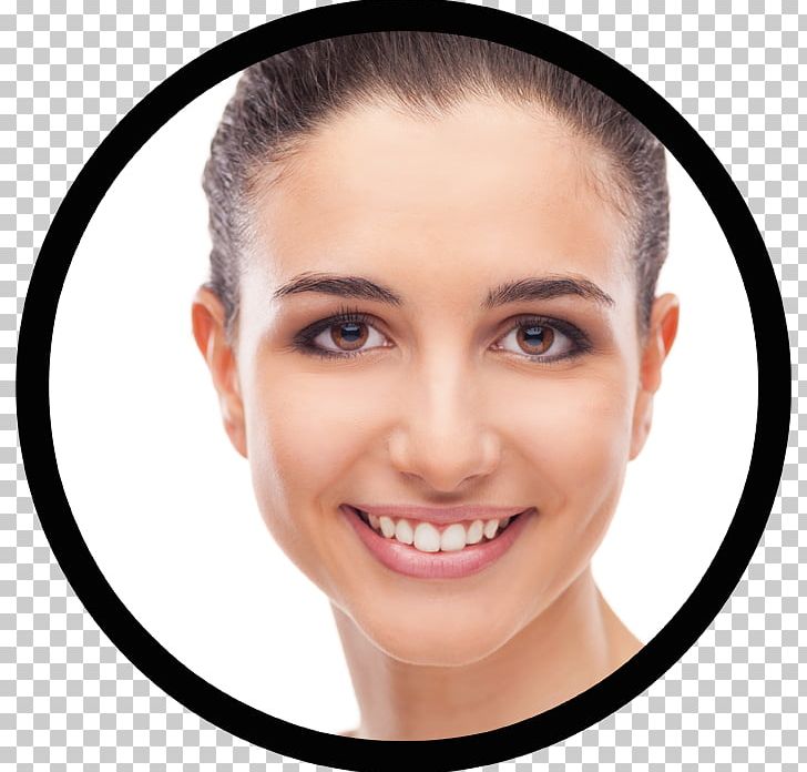 LASIK Eyebrow Contact Lenses KAMRA-Implantat PNG, Clipart, Cheek, Chin, Clinic, Contact Lenses, Eye Free PNG Download