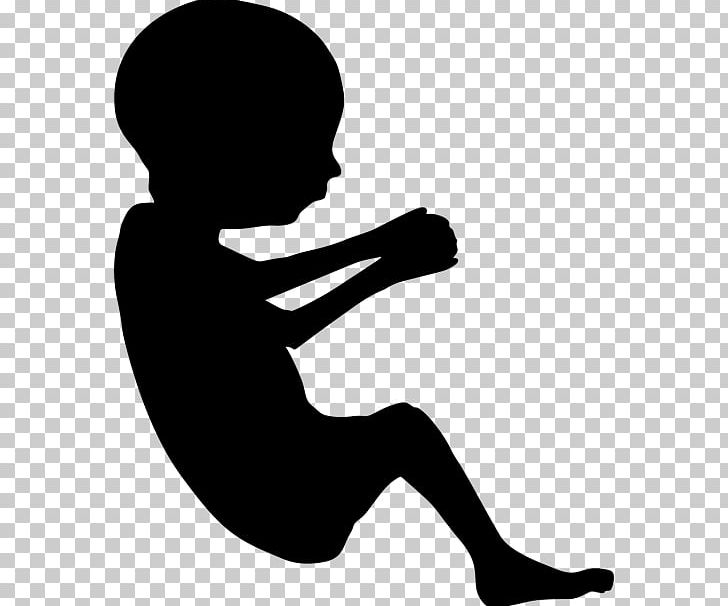 Fetus Pregnancy Infant Silhouette PNG, Clipart, Abortion, Arm, Black And White, Child, Childbirth Free PNG Download