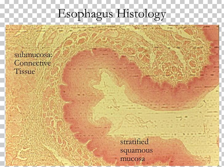 Esophagus Stratified Squamous Epithelium Simple Columnar Epithelium Histology PNG, Clipart,  Free PNG Download