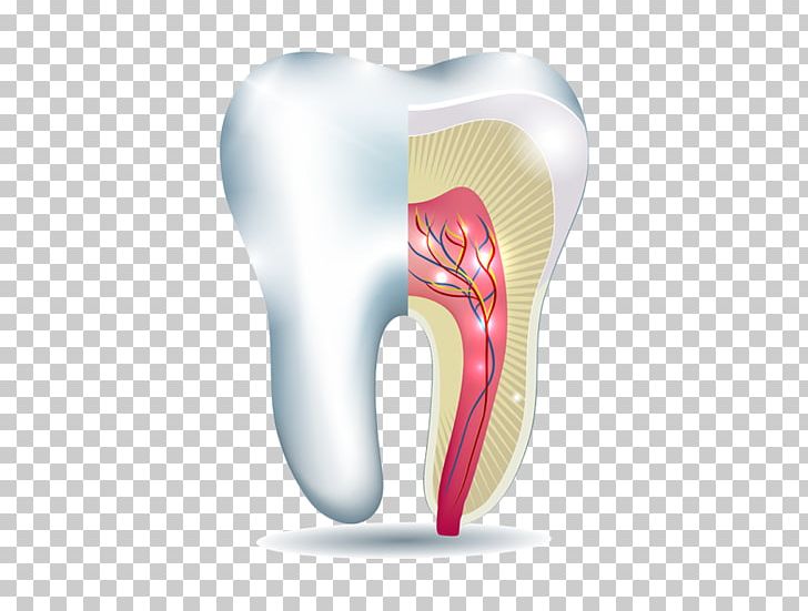 Tooth Whitening Dentin Tooth Enamel Dentistry PNG, Clipart, Cosmetic Dentistry, Crown, Dent, Dental Implant, Dental Restoration Free PNG Download