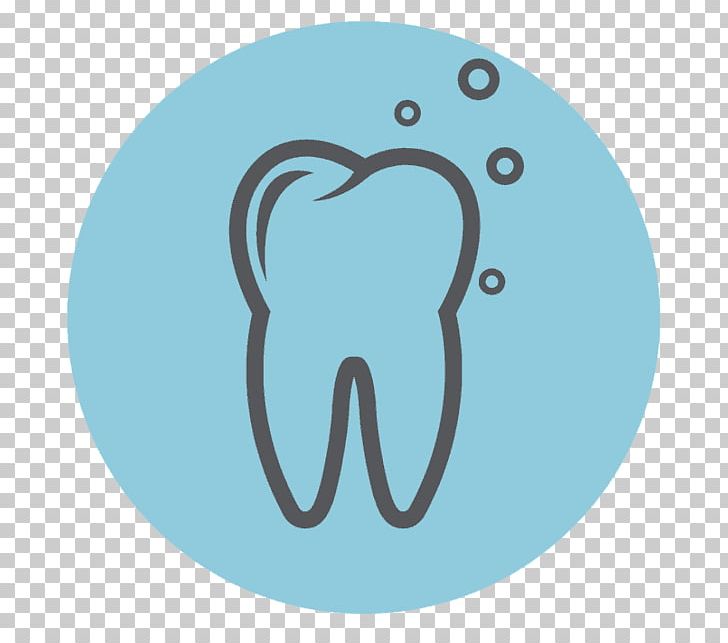 Tooth Decay Dentistry Inlays And Onlays Pulpitis PNG, Clipart, Anesthesia, Aqua, Blue, Cyst, Dental Smile Free PNG Download