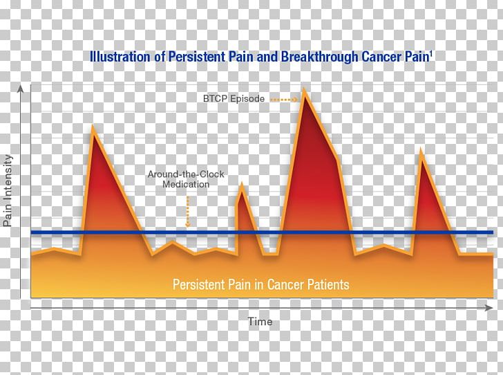 Cancer Pain Pain Management Therapy Opioid PNG, Clipart, Ache, Acupressure, Acute Pain, Angle, Area Free PNG Download