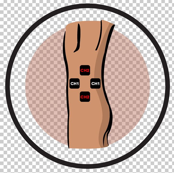 Hip Pain Transcutaneous Electrical Nerve Stimulation Electrical Muscle Stimulation Shingles PNG, Clipart, Ear, Electrical Muscle Stimulation, Electrode, Electrotherapy, Face Free PNG Download
