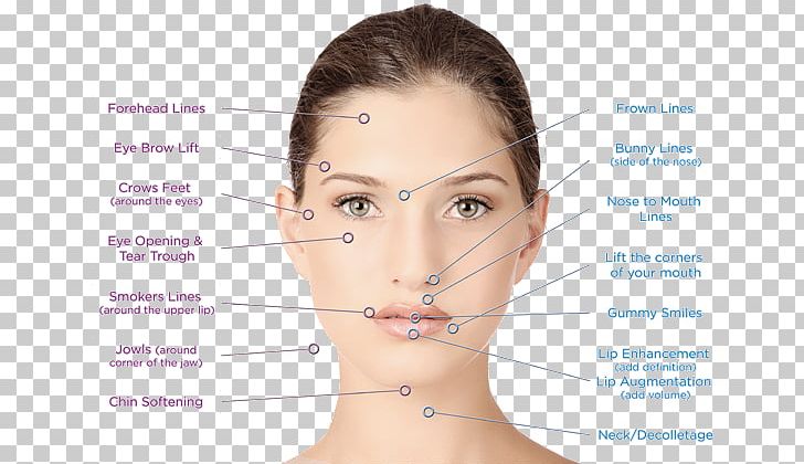 Facial Surgery Aesthetics Rhytidectomy Aesthetic Medicine PNG, Clipart, Aesthetic Medicine, Aesthetics, Aesthetics Cosmetics, Botulinum Toxin, Cheek Free PNG Download