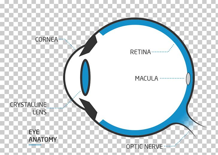 yag laser eye