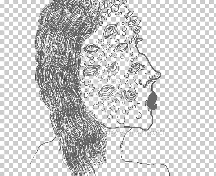 Visual Arts Line Art Sketch PNG, Clipart, Acne Skin, Art, Artwork, Black And White, Cartoon Free PNG Download