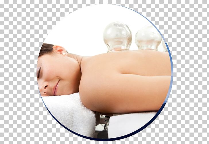 Cupping Therapy Massage Alternative Health Services Acupuncture PNG, Clipart, Acupressure, Alternative Health, Alternative Health Services, Arm, Bodywork Free PNG Download