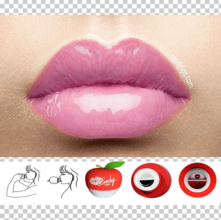 Lip Augmentation Beauty And The Peach Face Surgery PNG, Clipart, Beauty And The Peach, Cosmetics, Face, Health Beauty, Injection Free PNG Download