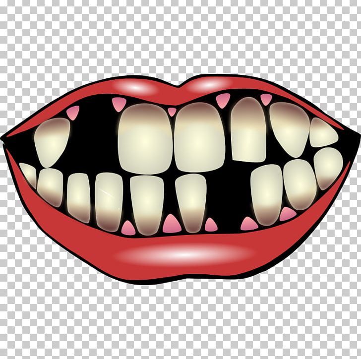 Joker Smile Tooth PNG, Clipart, Clip Art, Dentistry, Images, Images Teeth, Jaw Free PNG Download