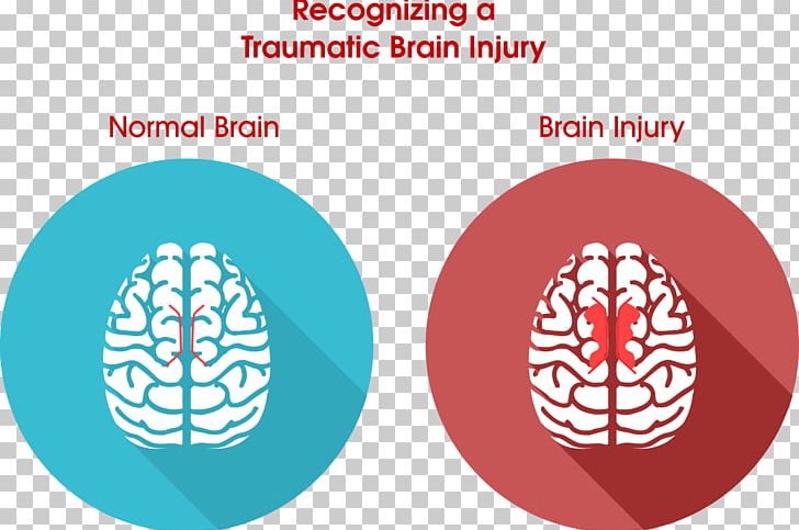 Traumatic Brain Injury Concussion Acquired Brain Injury PNG, Clipart, Acquired Brain Injury, Brain, Brain Damage, Brand, Child Free PNG Download