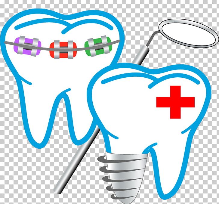 Dentistry Kanishka Dental Care & Orthodontic Centre Clinic Dental Surgery PNG, Clipart, Area, Clinic, Dental Hygienist, Dental Implant, Dental Restoration Free PNG Download