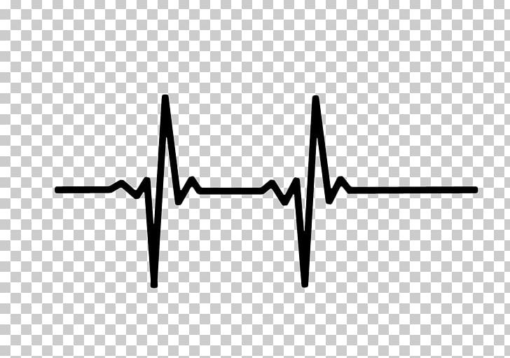 Heart Rate Monitor Pulse Electrocardiography PNG, Clipart, Angle, Black, Black And White, Bradycardia, Cardiac Monitoring Free PNG Download
