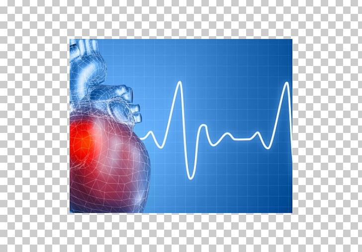 Heart Arrhythmia Disease Cardiology Heart Ailment PNG, Clipart, Cardiology, Cardiovascular Disease, Computer Wallpaper, Disease, Electric Blue Free PNG Download