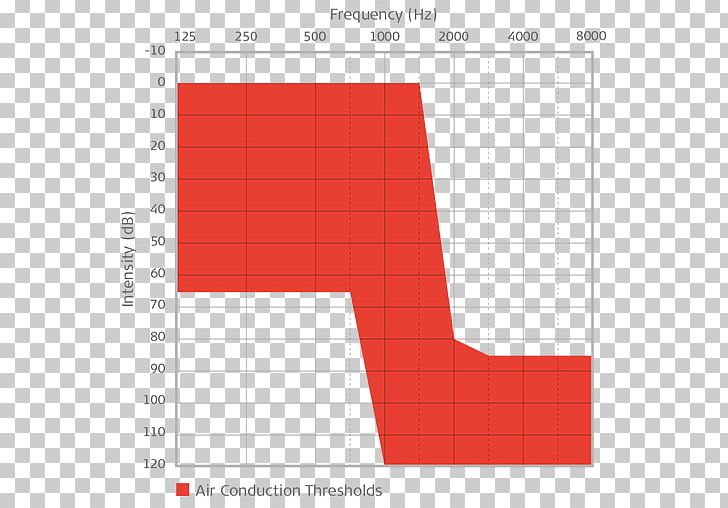 Cochlear Implant Audiometry Middle Ear Bone Conduction MED-EL PNG, Clipart, Angle, Area, Audiometry, Bone Conduction, Brand Free PNG Download