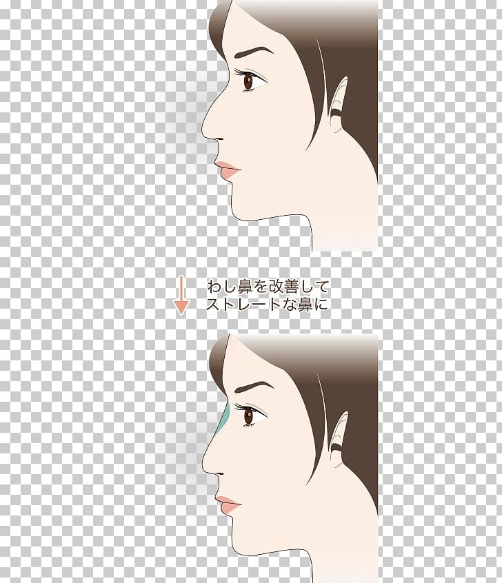 Ear Cheek Eyebrow Lip Chin PNG, Clipart, Arm, Black Hair, Cartoon, Cheek, Chin Free PNG Download