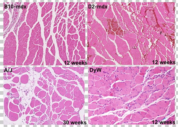 Duchenne Muscular Dystrophy Muscle Tissue Mdx Mouse PNG, Clipart,  Free PNG Download