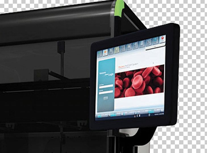 Laboratory Medical Diagnosis System Medicine Grifols PNG, Clipart, Blood Blots, Blood Plasma, Business, Computer Monitor, Computer Monitors Free PNG Download