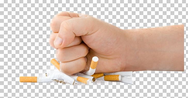 Smoking Cessation Smoking Relapse: Causes PNG, Clipart, Acupuncture, Addiction, Cigarette, Disease, Drug Free PNG Download