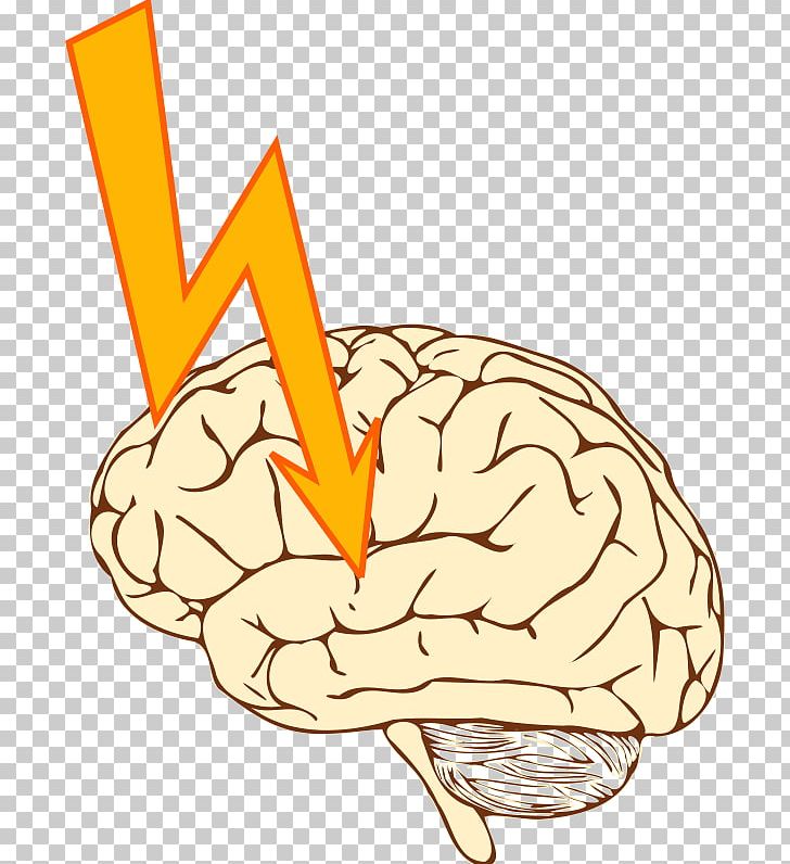 Featured image of post Epilepsy Clipart We are not medical experts or able to offer diagnoses and so we ask you seek medical attention