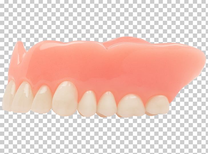 Tooth Dentures Dentistry Human Mouth Aspen Dental PNG, Clipart, Angle, Aspen, Aspen Dental, Basic, Dental Consonant Free PNG Download