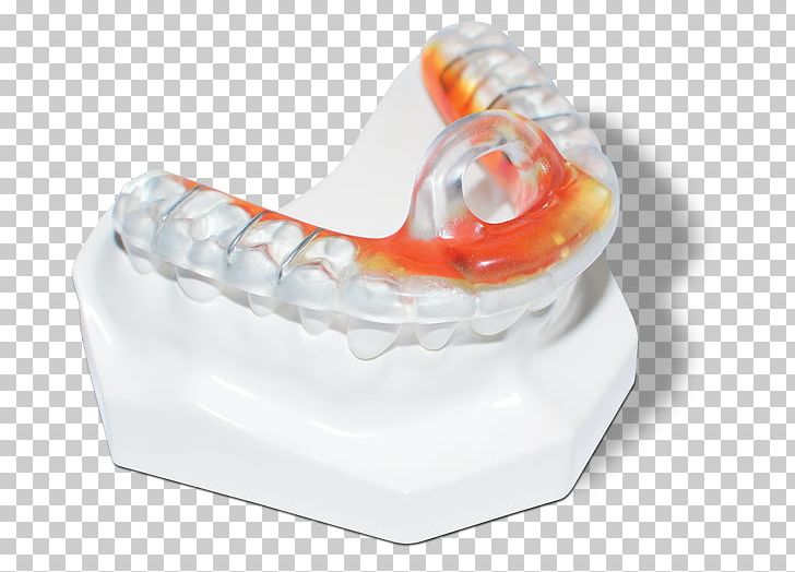 Mandible Bite Registration Tooth Temporomandibular Joint PNG, Clipart, 99designs, Bite Registration, Dentist, Home Appliance, Jaw Free PNG Download