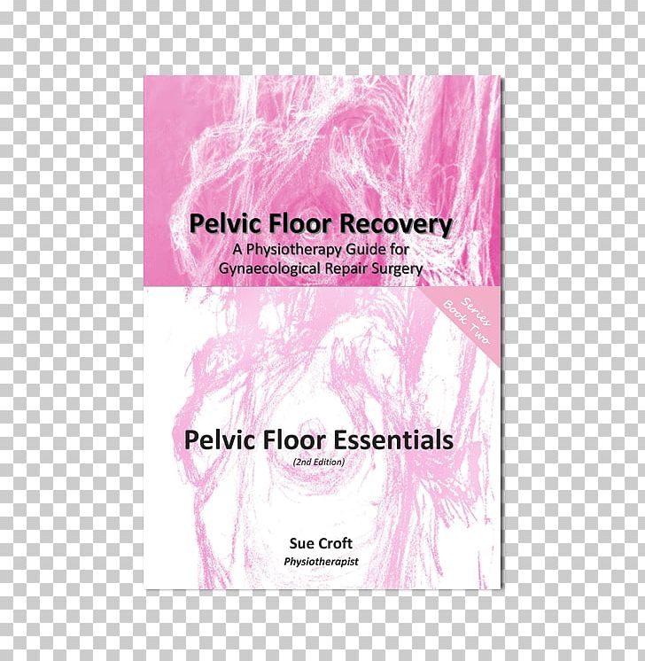 Pelvic Floor Dysfunction Rectocele Hysterectomy Surgery PNG, Clipart, Cystocele, Exercise, Hysterectomy, Kegel Exercise, Line Free PNG Download
