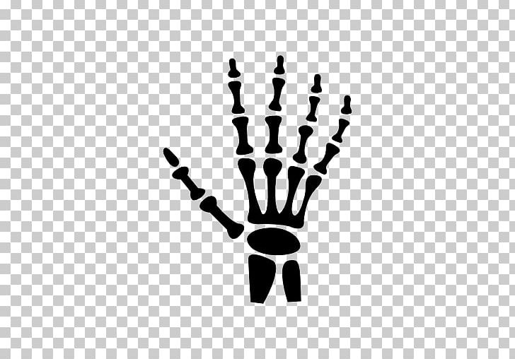 Bone Logo Joint Human Skeleton PNG, Clipart, Arm, Black And White, Bone, Bone Fracture, Bones Free PNG Download