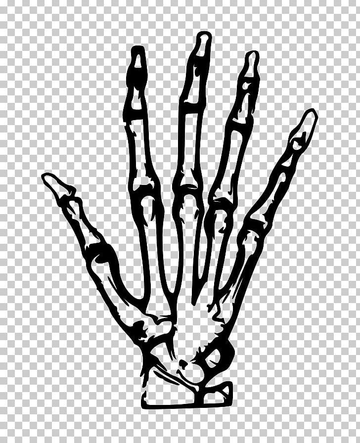 Human Skeleton Hand PNG, Clipart, Anatomy, Black And White, Bone, Carpal Bones, Drawing Free PNG Download