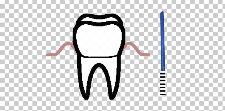 Tooth Prevention Of Periodontal Disease Periodontology PNG, Clipart, Angle, Cause, Dental Implant, Dentistry, Disease Free PNG Download