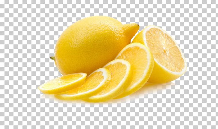 Food Eating Citric Acid Lemon PNG, Clipart, Acid, Apple Fruit, Citric Acid, Citron, Citrus Free PNG Download