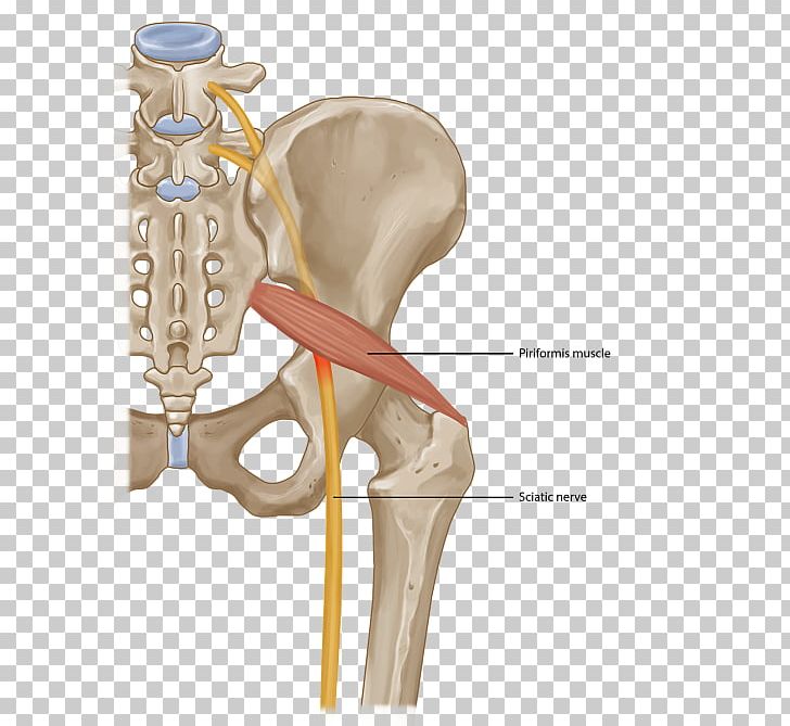 Piriformis Syndrome Piriformis Muscle Back Pain Injection Surgery PNG, Clipart, Ache, Acute Pain, Anabolic Steroid, Arm, Back Pain Free PNG Download