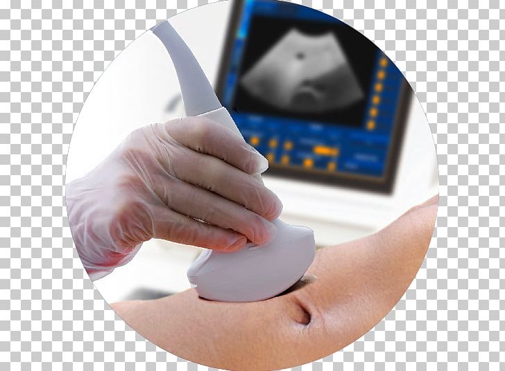 Ultrasonography Ultrasound Interventional Radiology Medicine PNG, Clipart, Computed Tomography, Drugdelivery, Elastography, Finger, Genetic Counseling Free PNG Download