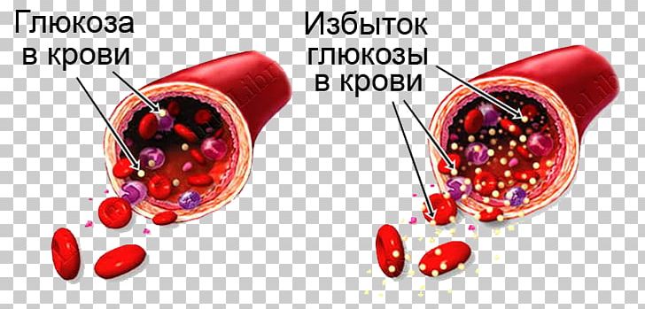 Blood Sugar Hypoglycemia Diabetes Mellitus Hyperglycemia PNG, Clipart, Blood, Blood Glucose Monitoring, Blood Sugar, Body Jewelry, Diabetes Mellitus Free PNG Download