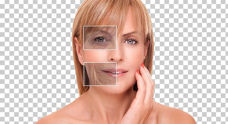 Plastic Surgery Wrinkle Medicine Botulinum Toxin PNG, Clipart, Aesthetics, Aging, Bangs, Beauty, Berlin Free PNG Download