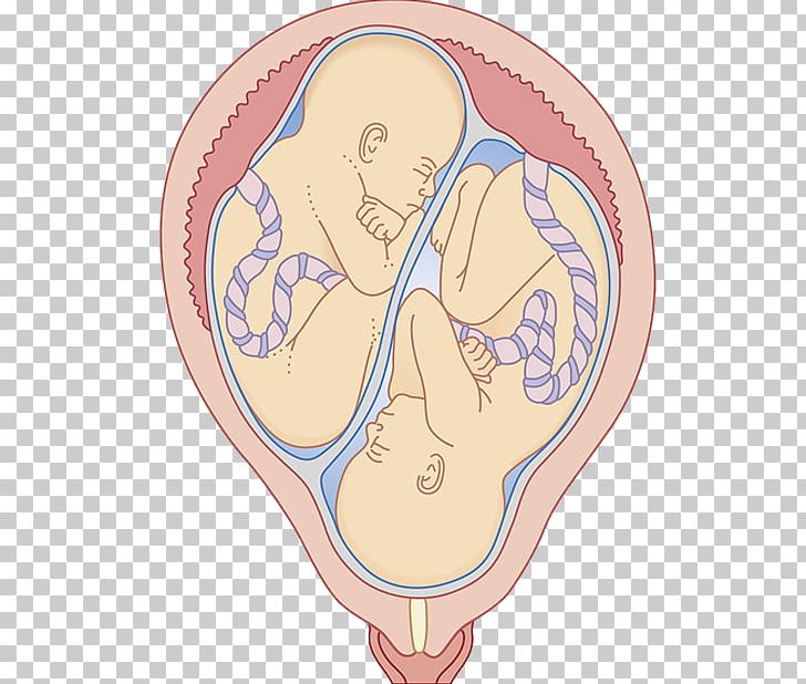 Twin Uterus Umbilical Cord Pregnancy Fertilisation PNG, Clipart, Arm, Baby, Egg, Embryo, Embryo Vector Free PNG Download