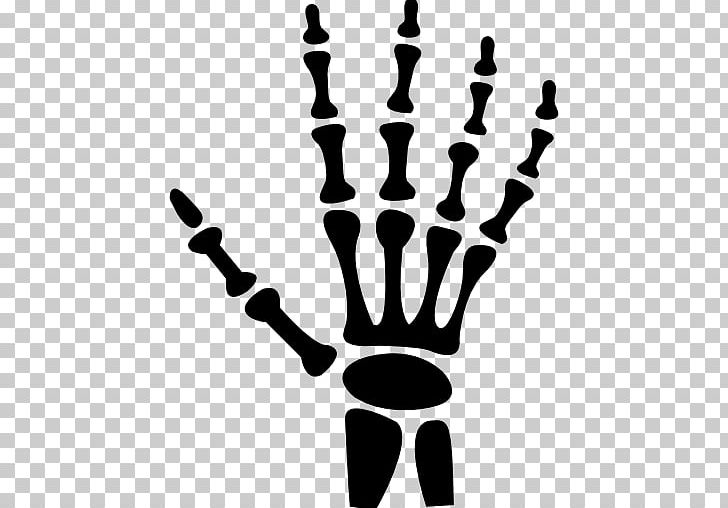 Hand Human Skeleton Bone PNG, Clipart, Black And White, Bone, Bones, Carpal Bones, Computer Icons Free PNG Download