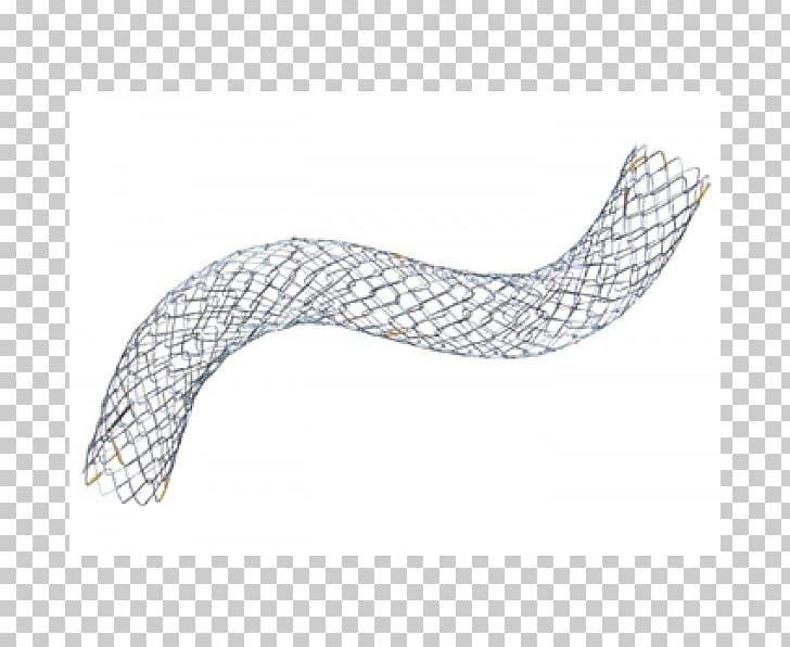 Stenting Bile Duct Stenosis Catheter Coronary Artery Disease PNG, Clipart, Angle, Bile Duct, Body Jewelry, Business, Catheter Free PNG Download