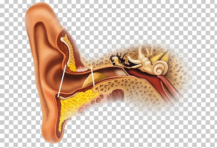 Earwax Ear Canal Gland Secretion PNG, Clipart, Auricle, Candles, Cotton Buds, Desquamation, Ear Free PNG Download
