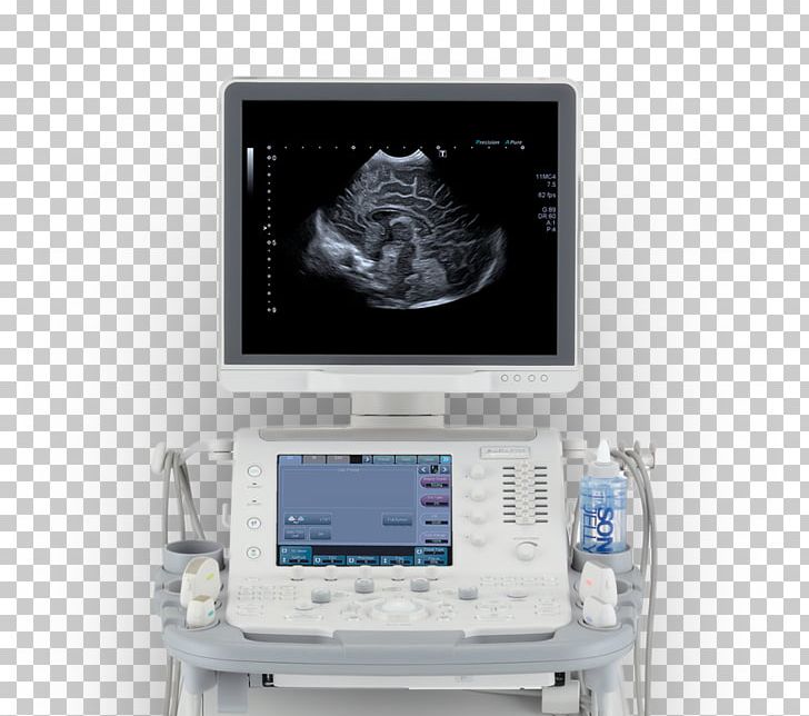 Ultrasonography Ultrasound Medical Diagnosis Patient Mindray PNG, Clipart, Canon Medical Systems Corporation, Electronic Device, Electronics, Medical, Medical Diagnosis Free PNG Download