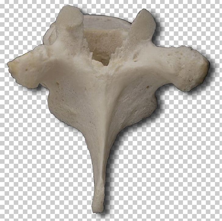 Vertebral Column Thoracic Vertebrae Cervical Vertebrae Lumbar Vertebrae Anatomy PNG, Clipart, Anatomy, Articular Processes, Artifact, Axial Skeleton, Bone Free PNG Download