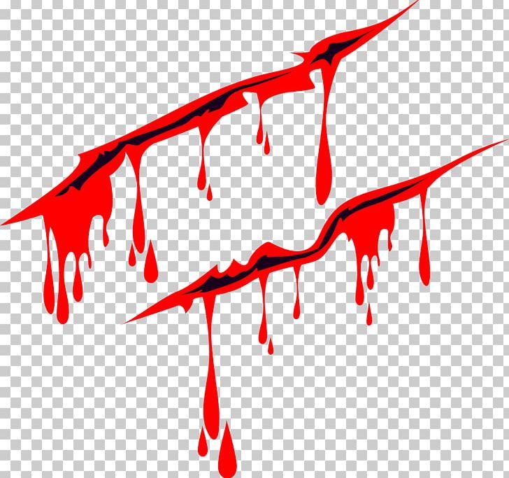 Blood Wound Computer File PNG, Clipart, Area, Bleeding, Blood Donation, Blood Drop, Blood Residue Free PNG Download